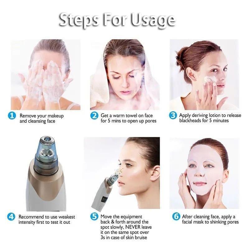 Black Head Remover