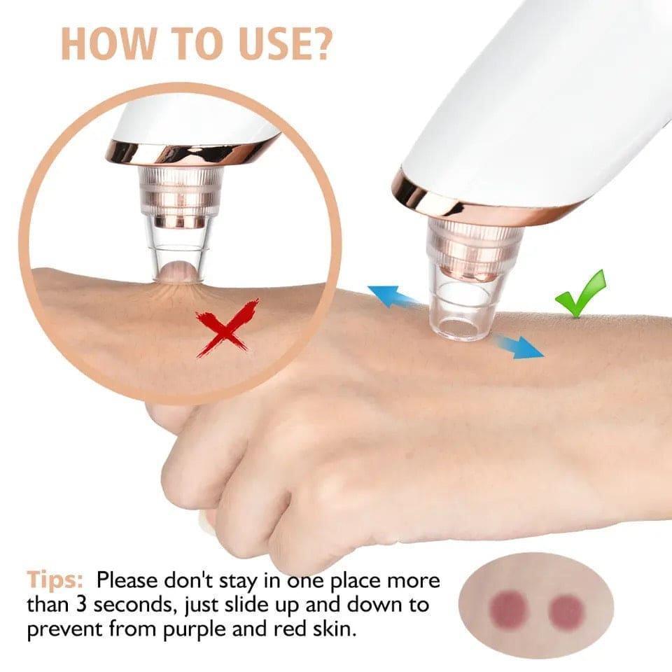 Black Head Remover